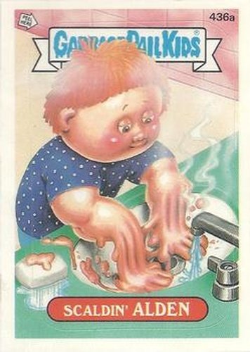#436a Scaldin' Alden - 1987 Topps Garbage Pail Kids Series 11